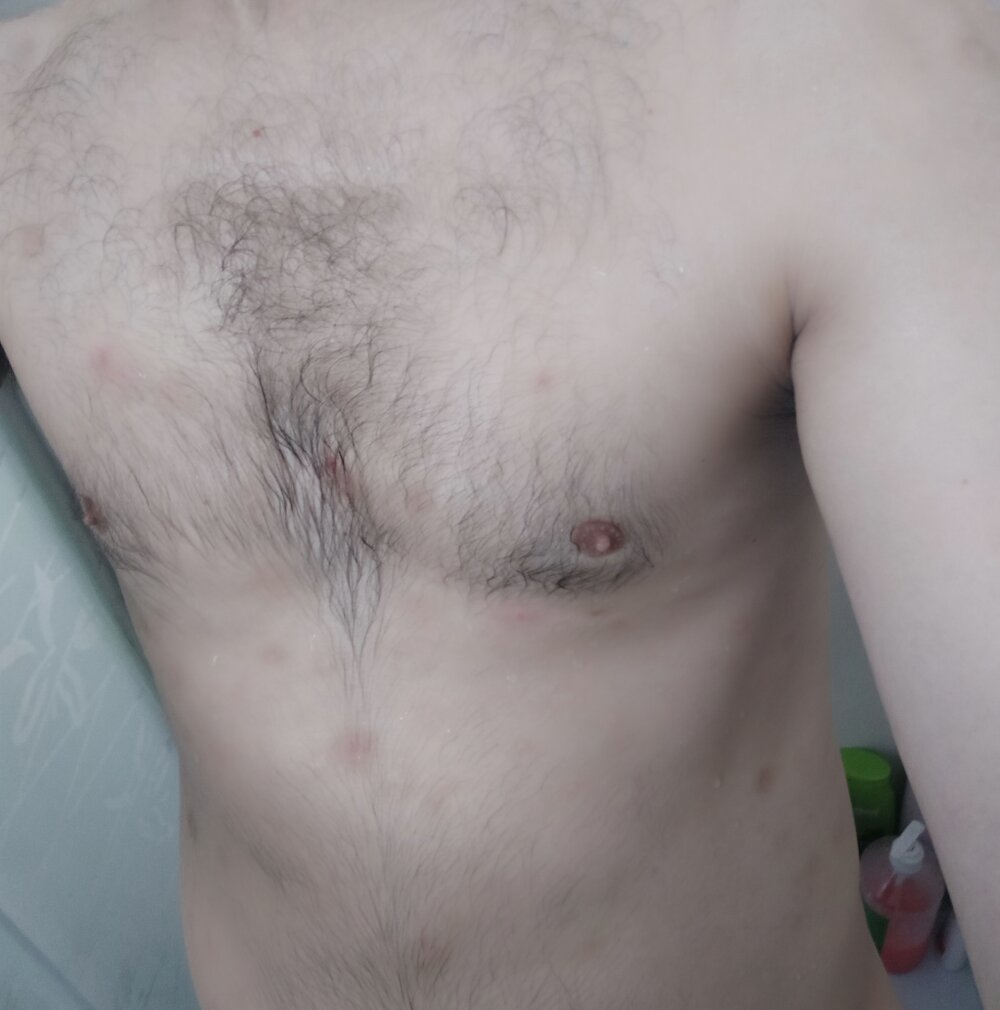Alexxxck