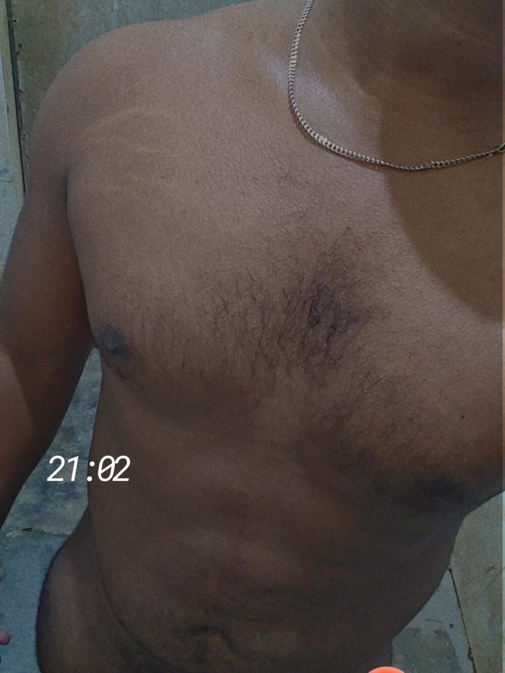 BANGALORE-DICK