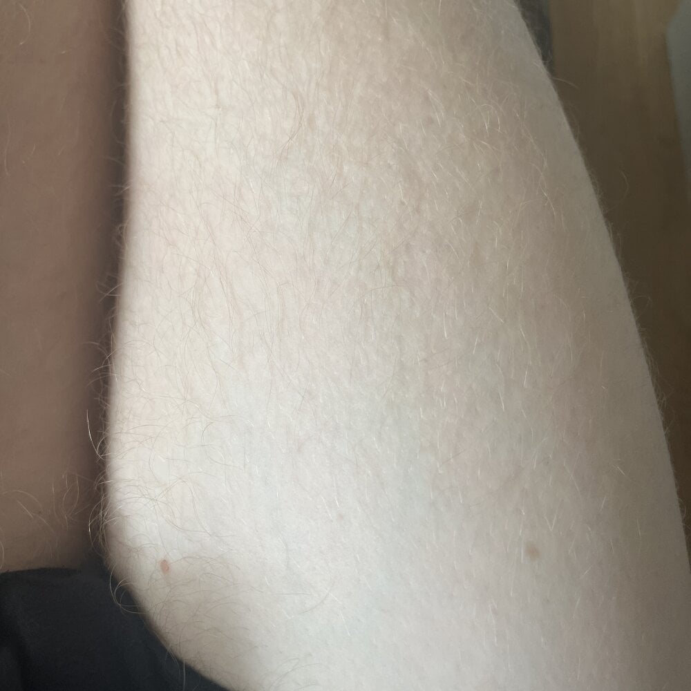 GER420x