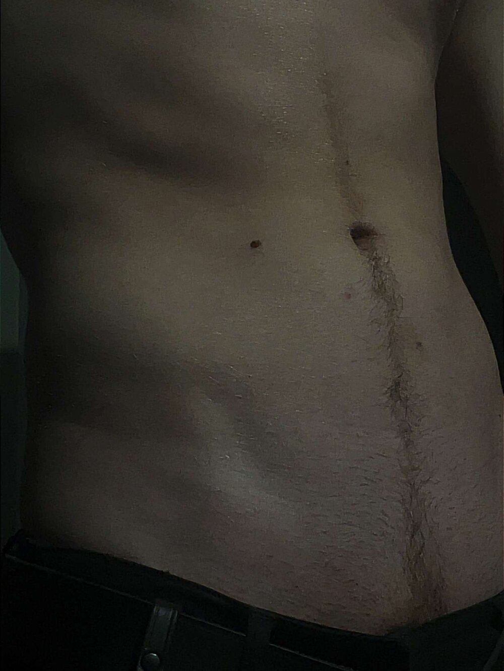 baretwinky