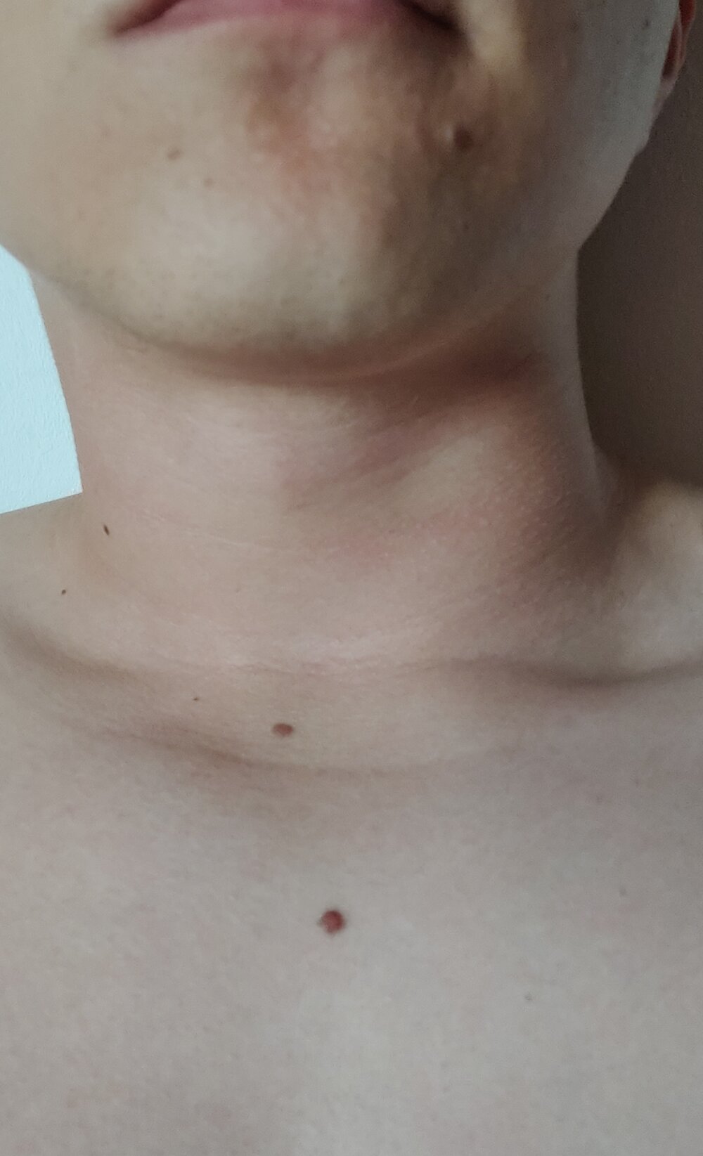 nippleboy2004